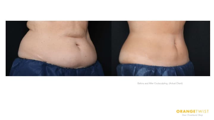 OrangeTwist Santa Clara