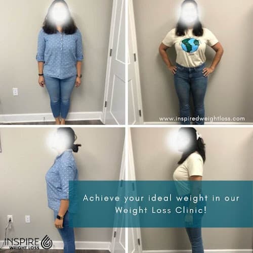 Inspire Weight Loss